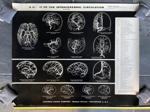 Orig 1960 chart brain - orig.,