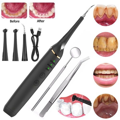Electric ultrasonic tooth - ultrasonic,
