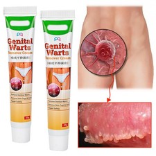 Genital Herpes Wart Remover Ointment Skin Tag Mole Acuminatum Treatment Cream