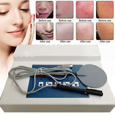 High Frequency Spider Veins Removal Anti Redness Machine Red Blood Vessel NEW UK