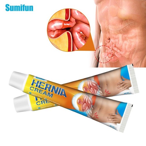 New hernia inguinal - new, treatment