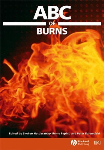 Abc burns - abc,