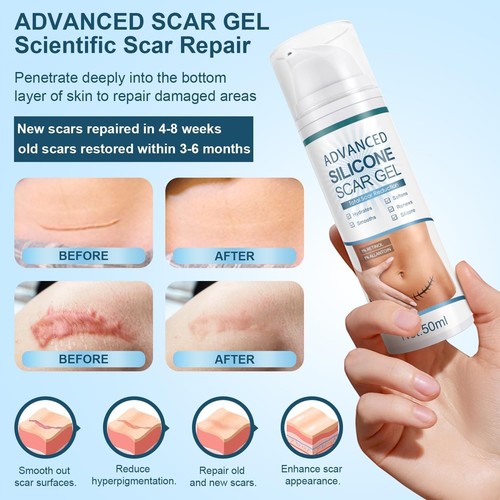 50ml advanced silicone scar - silicone,