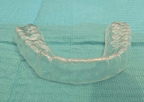 Custom dental orthodontic - custom,