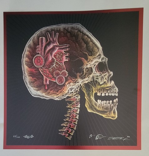 Emek ray skull - x-ray, with