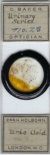 Human urinary series uric - human,