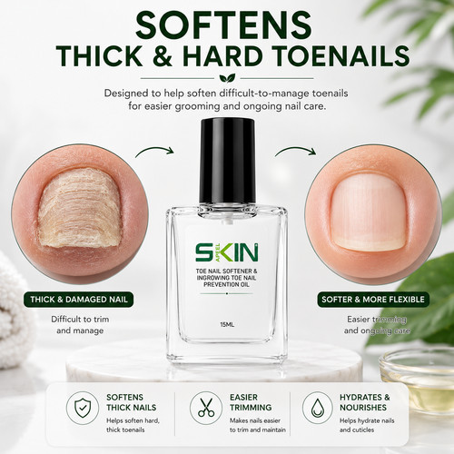 Toe nail softener softens - nail, |