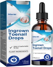 Ingrown Toenail Treatment