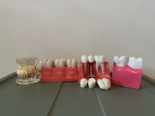 Dental Teaching Model Set – Tooth, Implant & Cavity Demonstration Kit