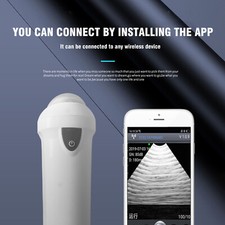 Wireless Veterinary Ultrasound