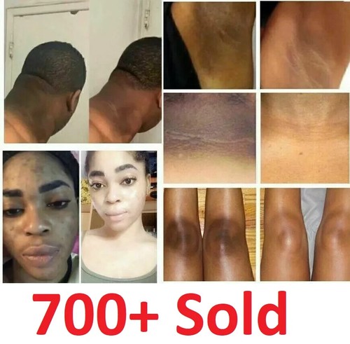 Dark skin bleaching cream - dark,