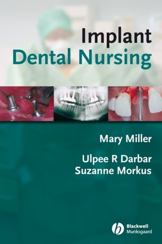 Implant dental nursing - implant,
