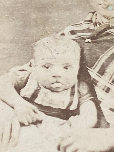 Rare antique medical condition - rare,