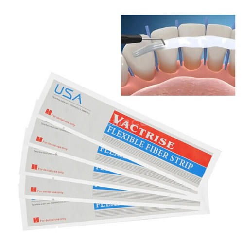 Dental glass splint loose - glass,