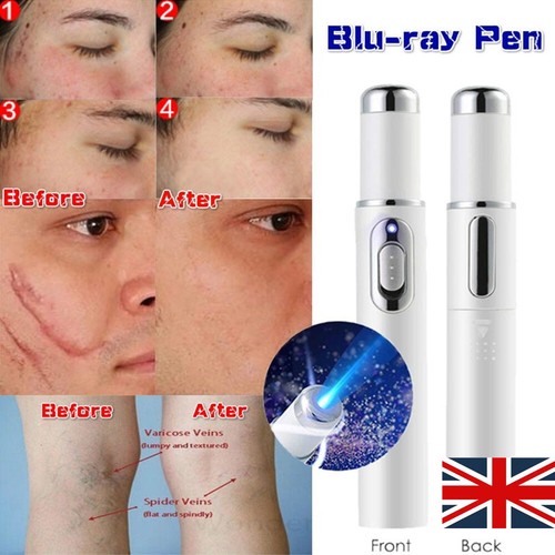 Medical blue light therapy - blue,