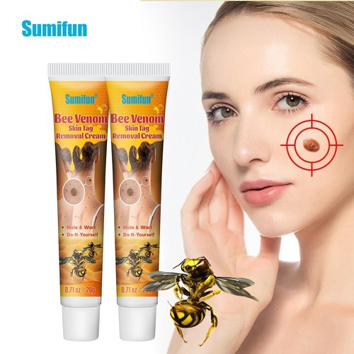 New 20g warts remover ointment - new,