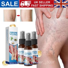 Natural Ingredients Veinguard Herbal Spray Varicose Vein Soothing Spray For Legs