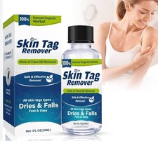 Skin Tag Remover 100% Natural