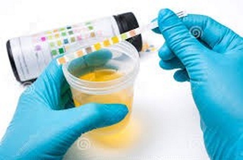 Urine test strips 10 - strips,
