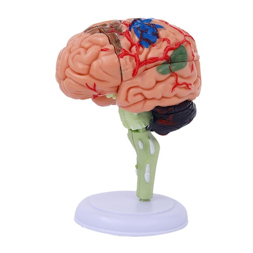 Disassembled anatomically - 4d,