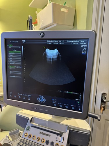 Rab4 ultrasound probe - ge,