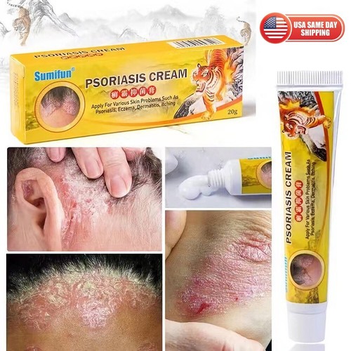 Health care psoriasis cream - care,