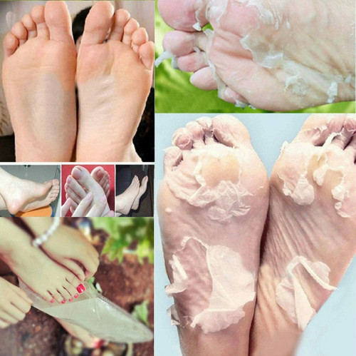 Exfoliating foot peel mask - foot,