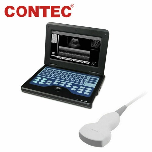 Portable ultrasound scanner - portable, b-ultrasound