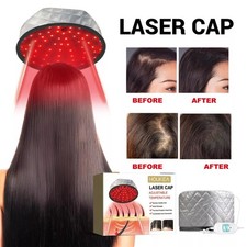 Electric Hair Steamer Heating