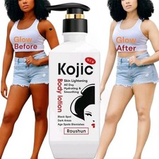 Kojic Body Lotion Skin