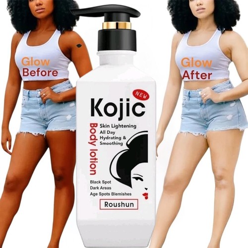 Kojic body lotion skin - kojic,