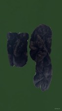 Faux Fur Mittens and Scarf Set