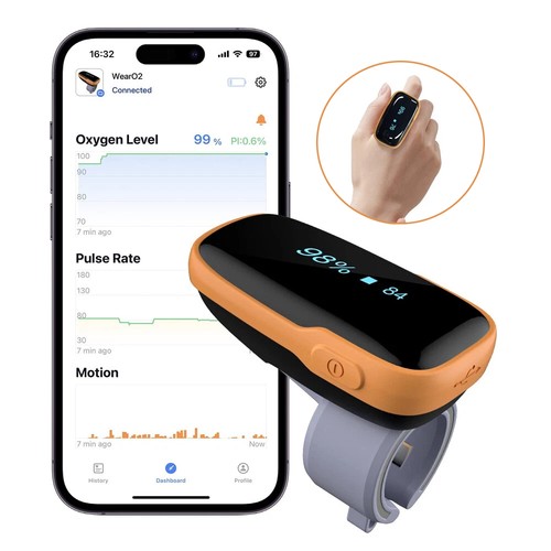 Wellue wearo2 ring - ring, oximeter