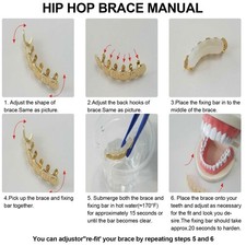 Plating Teeth Brace Set