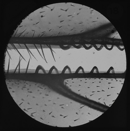 Microscope photo hind legs - microscope, of