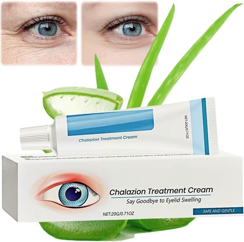 Chalazion treatment cream - chalazion,