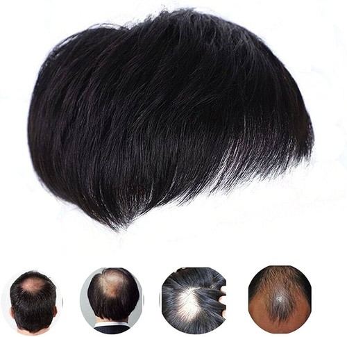 Synthetic wig top - top, lncrease