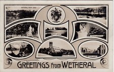 Attractive Multiview