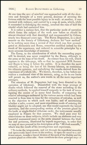Lithotomy midwifery an - lithotomy, :