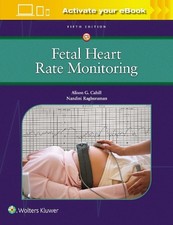 Fetal Heart Rate Monitoring - 9781975216184