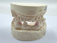 Vintage Plaster Dentist Medical Upper & Lower Teeth & Mouth Denture Mould
