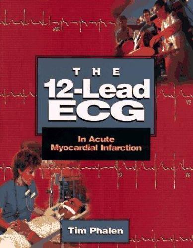 The lead ecg - ecg, acute