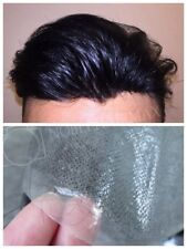 Mens Hair Replacement System