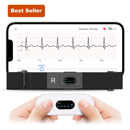 Checkme er2 mobile ecg ekg - er2-s,