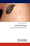 Leech Therapy: Blood Letting in Non healing Ulcers