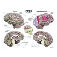 brain model for sale