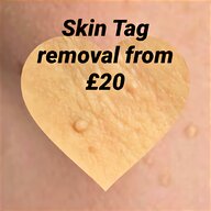 skin tag remover for sale