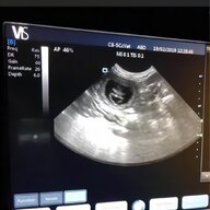 portable ultrasound for sale
