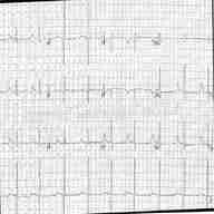 12 lead ecg for sale