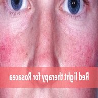 red light therapy rosacea for sale